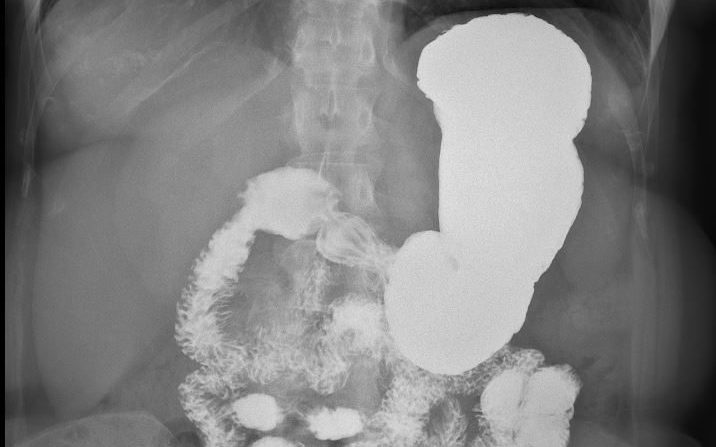 Fluoroscopy - Peninsula Imaging